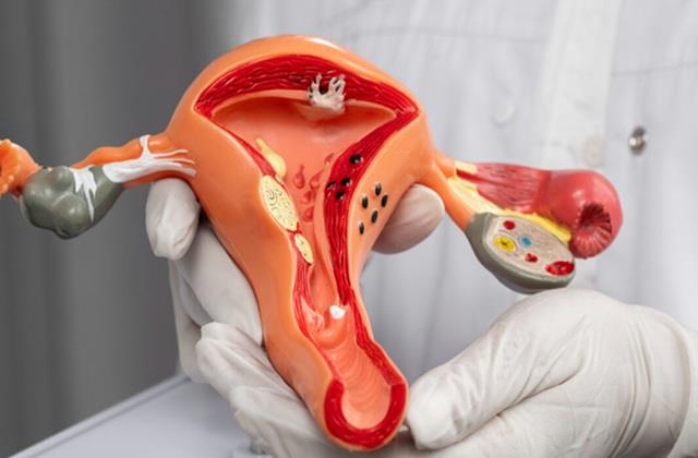 रोका जा सकता है सर्वाइकल कैंसर,  फिर भी हर 8 मिनट में इससे क्यों हो रही महिलाओं की मौत?