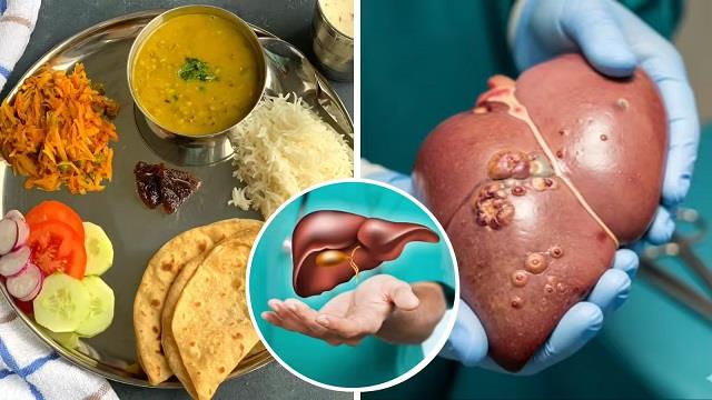 फैटी लिवर को 2 महीने में कैसे करें रिवर्स? बस प्लेट में रखें ये 3 चीजें