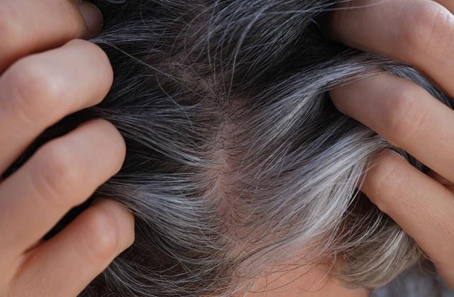कम उम्र में सफेद हो रहे हैं बाल? इस मसाले को जलाकर बनाएं पाउडर, जानें कैसे लगाएं