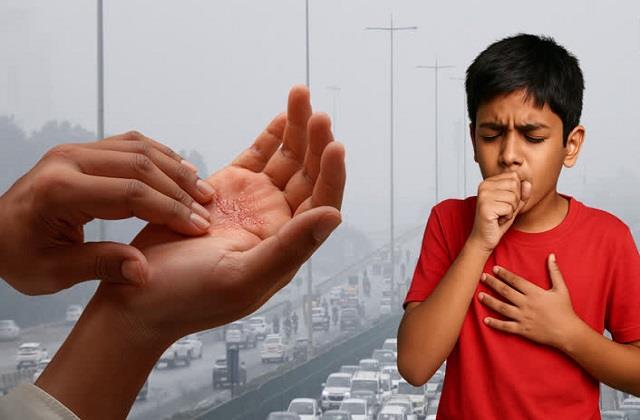 सांस से लेकर त्वचा तक, सूखी ठंड सेहत के लिए क्यों बढ़ाता है खतरा