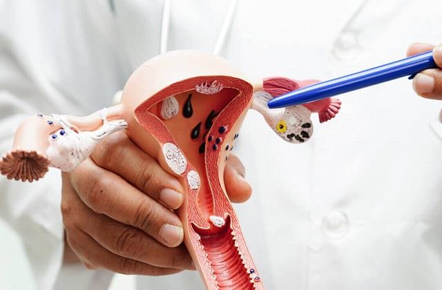 महिलाओं में सबसे ज्यादा होने वाला कैंसर कौन सा है? जानें Periods के बाद भी क्यों आता है Blood