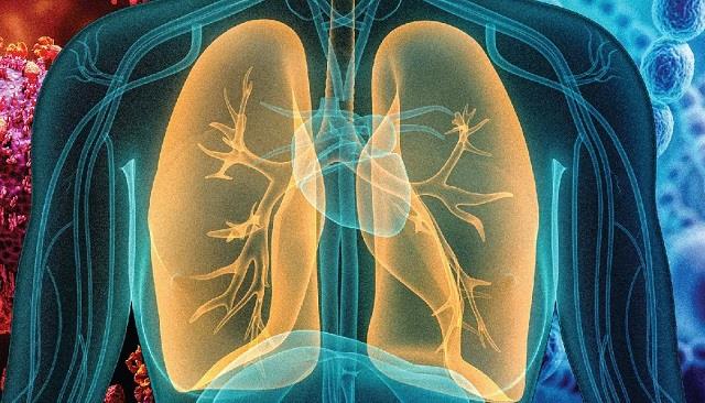 निमोनिया होने पर शरीर के कौन-कौन से अंग होते हैं प्रभावित? एक्सपर्ट से जानिए