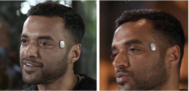 जोमैटो CEO के सिर पर दिखा अनोखा डिवाइस,क्या यही है बिजनेस माइंड का सीक्रेट?