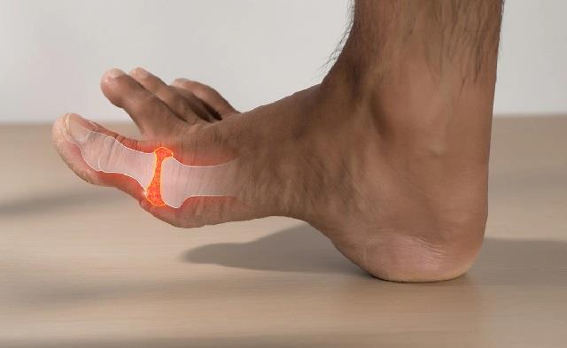 यूरिक एसिड के मरीजों के लिए यह एक चीज बन सकती हैं खतरा !