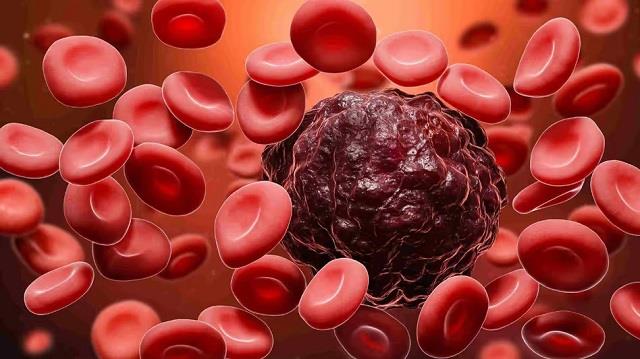 मरीजों के लिए बड़ी राहत की खबर, अब एक ही ब्लड टेस्ट से पकड़ी जाएंगी कई बीमारियां