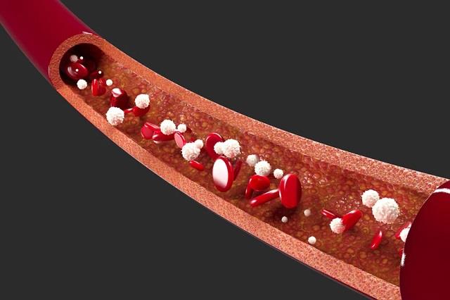 “बिना सप्लीमेंट सूख रही नसों में बढ़ाएगा ब्लड, बस ये  आयुर्वेद के 3 उपाय अपनाएं