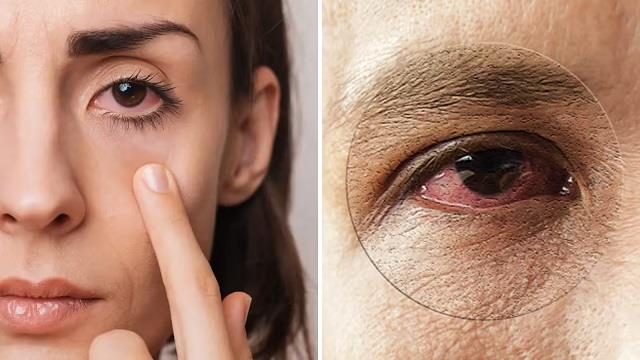 ठंड में आपकी आंखों से भी निकल रहा है पानी तो जान लें इसके कारण