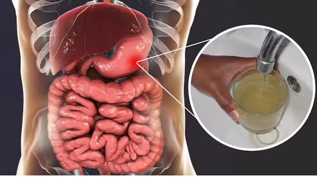 गंदा पानी पीने से 17 लोगों की मौत! CDC ने घर पर पानी शुद्ध करने के टिप्स दिए