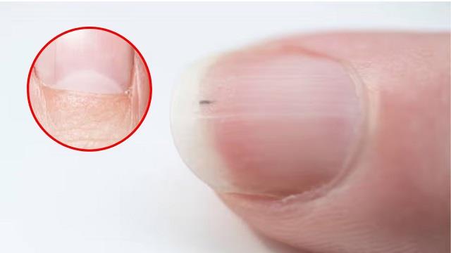 नाखूनों पर आधा चांद क्या होता है इसका मतलब? हर उंगली पर अलग संकेत