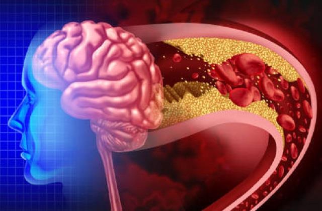 Brain सही से काम नहीं कर रहा, अगर दिखें ये लक्षण तो तुरंत करवाएं चेकअप