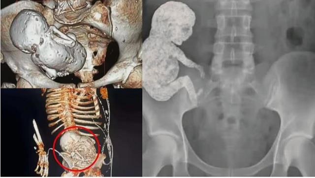 82 साल की महिला की SHOCKING रिपोर्ट,जानकर आप भी रह जाएंगे दंग