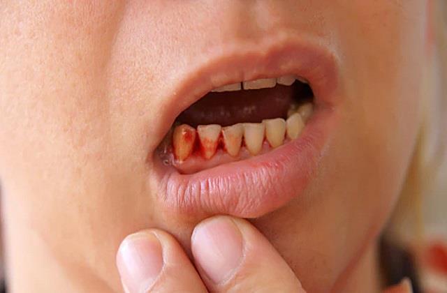 ये 2 लक्षण बता रहे हैं शरीर में इस खास विटामिन की भारी कमी