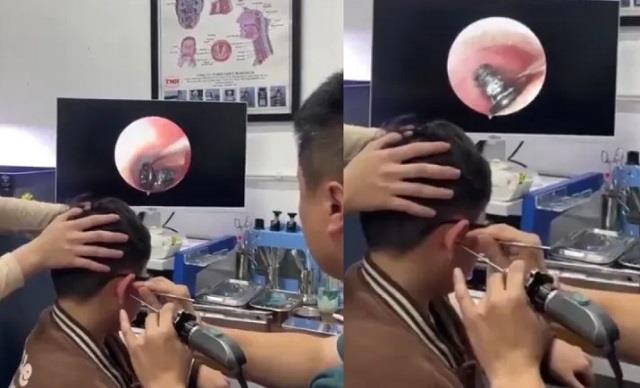 हैरान कर देने वाला मामला- बच्चे के कान में फंसी इस चीज, डॉक्टर भी देखकर रह गए दंग