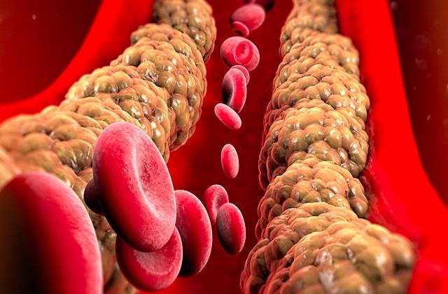 घटेगा खराब Cholesterol कम होगा हार्ट अटैक का खतरा, सिर्फ 2 दिन खाएं ये एक ब्रेकफास्ट