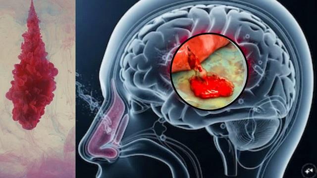डॉक्टरों की चेतावनी! ये 5 दवाइयां खाने से पहले सोचो, Brain पर डाल रही बुरा असर