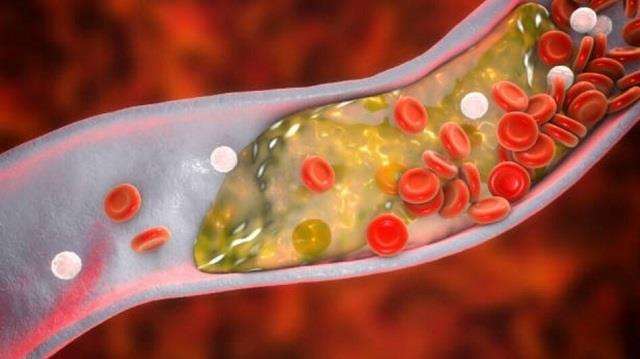 हाई कोलेस्ट्रॉल कम करने के लिए कौन सी सब्जियां और फूड्स फायदेमंद हैं?