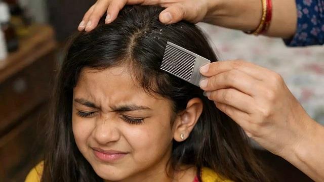 जूं बनी 12 साल बच्ची की मौत की वजह? बेटी ने इतना दर्द सहा कोई यकीन नहीं कर पाएगा