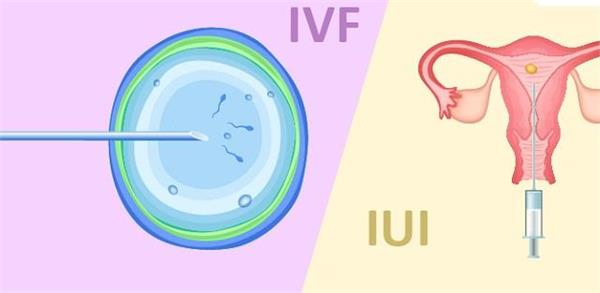 IUI और IVF में क्या अंतर है? जानें कौन सा फर्टिलिटी ट्रीटमेंट कब ज़रूरी होता है