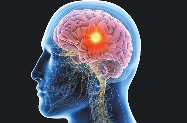 इस विटामिन की कमी से सिकुड़ जाएगी दिमाग की सारी नसें, Brain को डेमेज करती