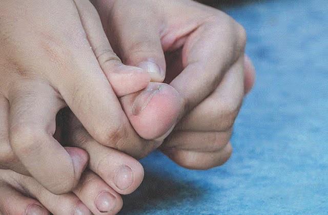 पैरों के अंगूठे दर्द होने के पीछे के संकेत, ये कारण पढ़ लें