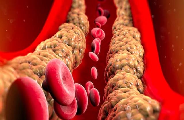 रोज इस तरीके से पिएं मेथी का पानी, नसों में जमा गंदा कोलेस्ट्रॉल धीरे-धीरे होगा साफ