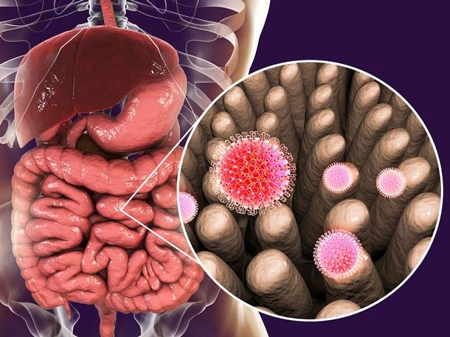 आंतों में छिपा ये खतरा बढ़ा सकता है कैंसर का रिस्क, समय रहते पहचान जरूरी