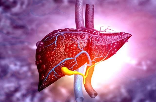 चेहरे पर दिखें ये 5 संकेत तो समझ लें लिवर खतरे में है, समय रहते करें बचाव