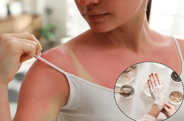 गर्मियों में टैनिंग से हाथ हो गए काले तो अपनाएं ये देसी नुस्खे