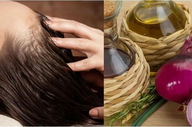 कच्ची प्याज से बालों का झड़ना होगा कम, बस अपनाएं ये आसान रसोई वाला जुगाड़