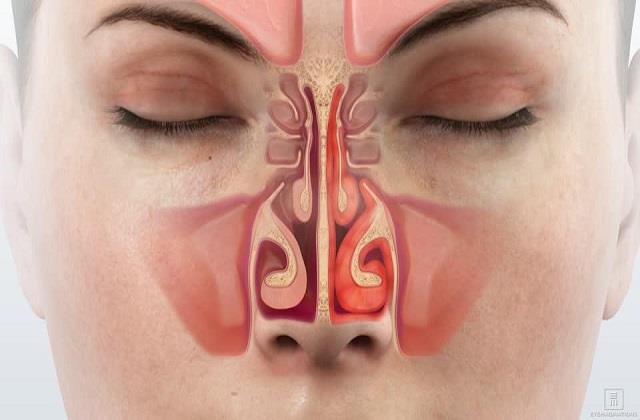 क्या आपकी नाक भी हो रही है बड़ी? जानिए इसके पिछे कारण