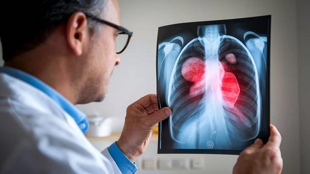 मामूली लगने वाले ये छोटे लक्षण देते हैं  Lung Cancer का संकेत