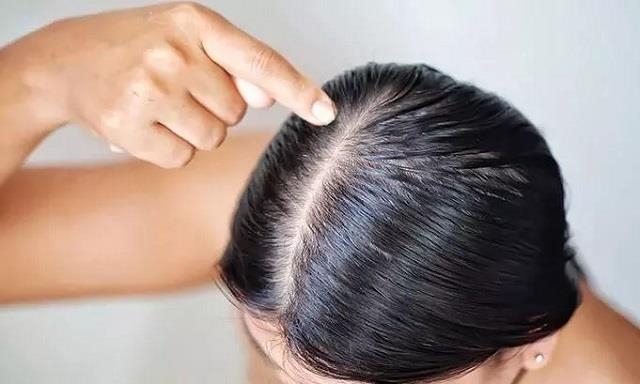 OilyScalp और चिपचिपे बाल? गर्मियों में ये हेयर मास्क होंगे सबसे बेहतरीन