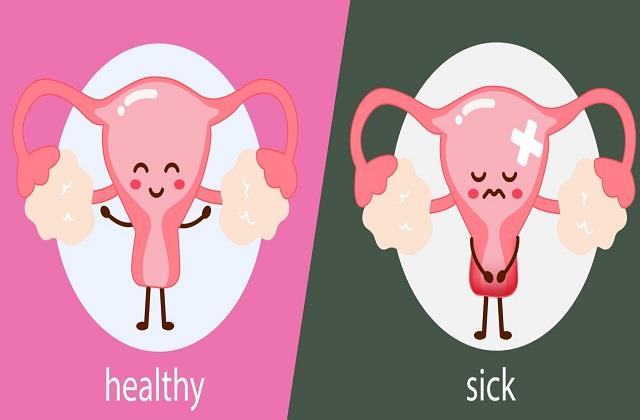 बच्चेदानी मोटी होगी तो खराब हो जाएगी Health, इसके लक्षण-कारण और इलाज भी जानिए