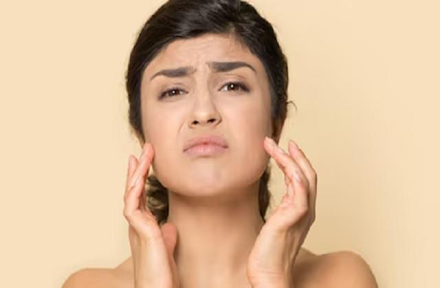 गर्मी में झुलस गई स्किन? अपनाएं डॉक्टर के बताएं ये उपाय, गुलाब की तरह खिल जाएगा चेहरा