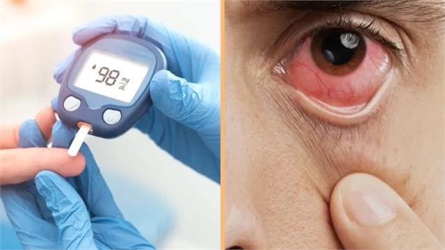 शुगर कंट्रोल करने वाली यह दवा छीन सकती है आंखों की रोशनी!