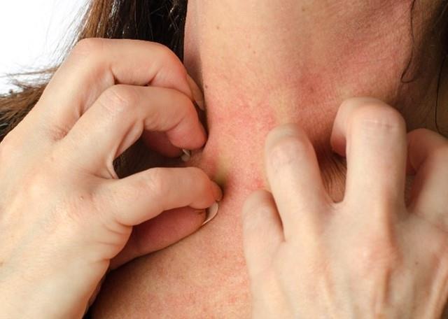 किडनी की बीमारी में स्किन क्यों बदलती है? शुरुआती लक्षणों को ना करें अनदेखा