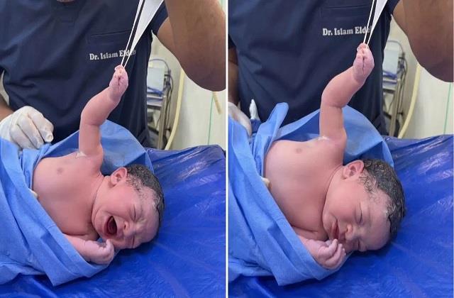 क्या कमाल का बच्चा है! पैदा होते ही ले लिया डॉक्टर से पंगा, देखिए Viral Video