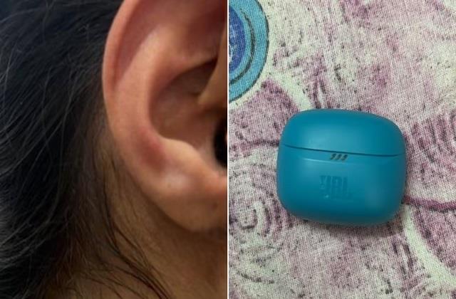 कान में फटा ईयरबड! यूजर के दावे से मचा हड़कंप, अब ईयरबड भी बन गया खतरा?