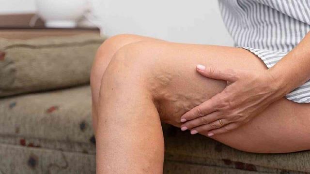 जांघों में खुजली क्यों होती है? शरीर में इस विटामिन की कमी हो सकती है वजह