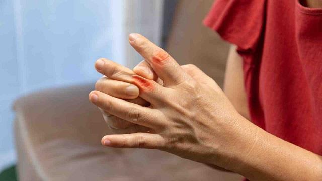 उंगलियां में दर्द और सूजन हो सकता है इस गंभीर बीमारी का संकेत