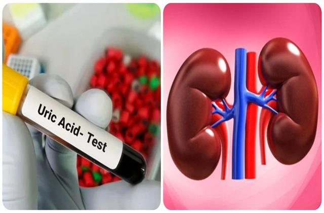 हार्ट अटैक और फैटी लिवर जितना ही खतरनाक है Uric Acid, यह Kidney का कर देता है बुरा हाल