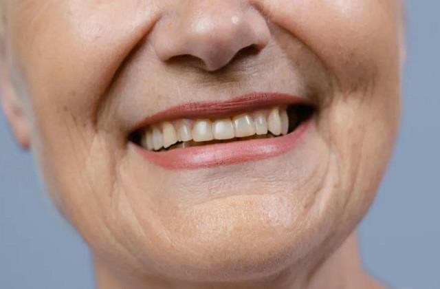 क्या ज्यादा चीनी खाने से पीले हो जाते हैं दांत? जानें इसके नुकसान