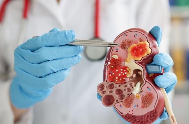 किडनी को रखें साफ और हेल्दी, जानें बेस्ट हर्बल टी और उनके फायदे