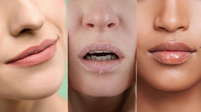 बदलता होंठो का रंग होता है इन 4 बीमारियों का संकेत!