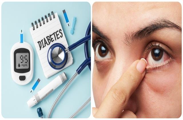 आंखों को सबसे जल्दी अपना शिकार बनाती है Diabetes, जल्द नहीं दिखाई देते लक्षण