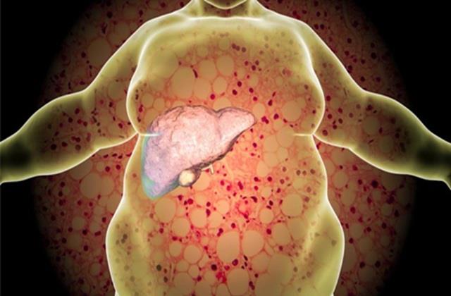 अचानक पतले से हो गए मोटे तो तुंरत चैक करवा लो अपना  Liver