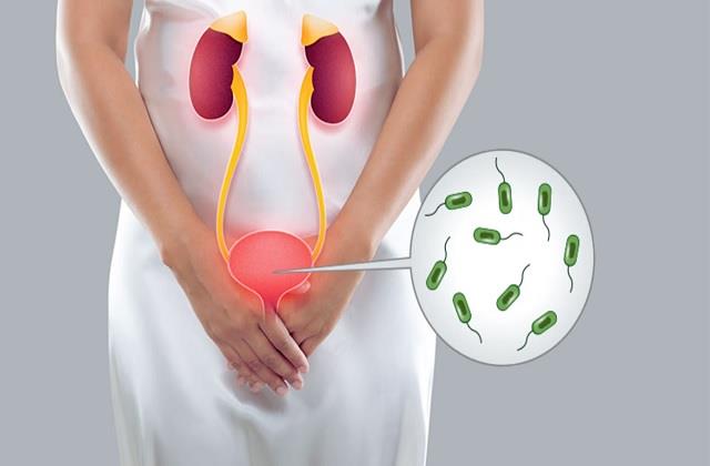 UTI क्या है? एक्सपर्ट से जानें इसके कारण, लक्षण और कैसे करें इलाज