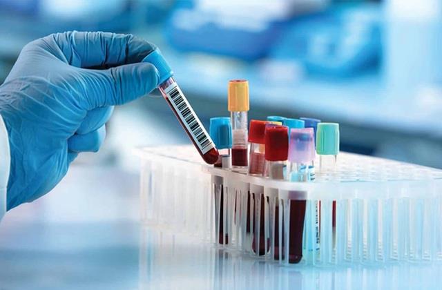 हर Blood Test नहीं बताता सेहत का पूरा हाल, बीना लक्षण के भी शरीर हो जाता है बीमार