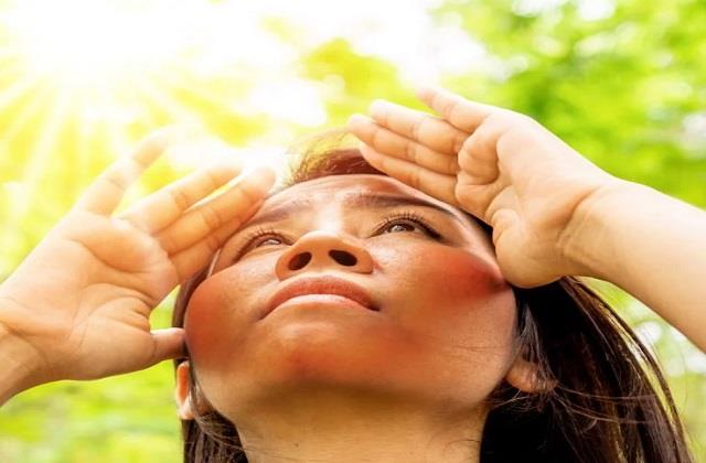 गर्मियों की तेज धूप से झुलस गई है स्किन तो अपनाएं ये देसी उपाय