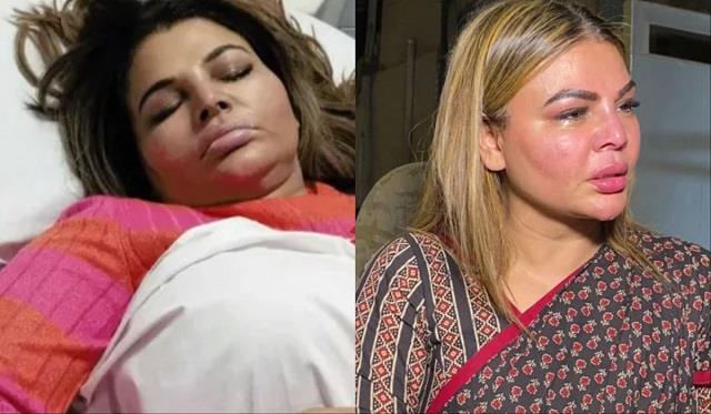 “मां के कहने पर गलत आदमी से शादी कर ली…”Rakhi Sawant ने बयां किया दर्द, Ex-पति पर लगाए गंभीर आरोप